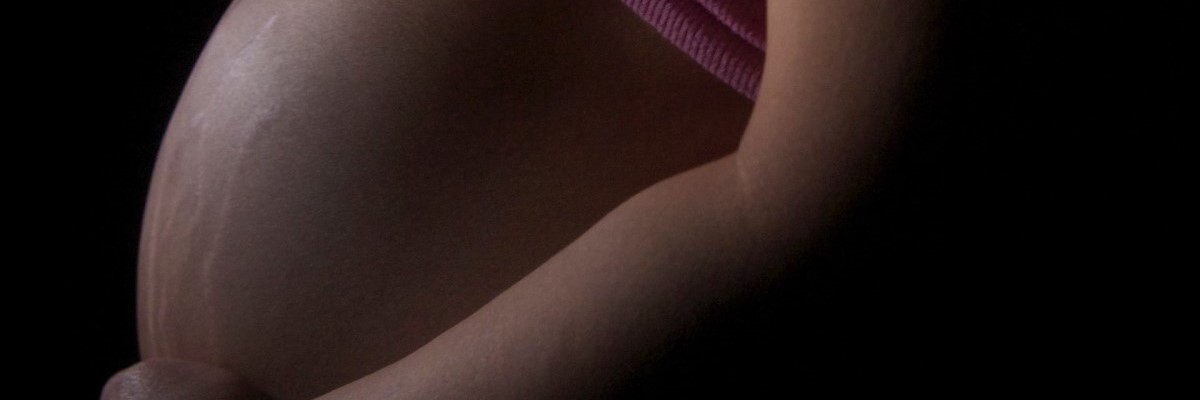 Как избавиться от растяжек на теле