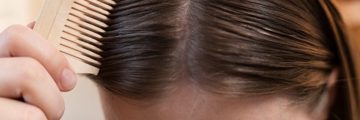 Рейтинг шампуней от перхоти